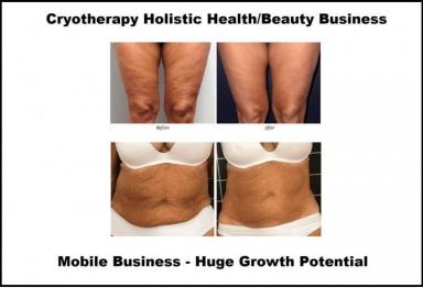 Business For Sale - QLD - Burleigh Heads - 4220 - Cryotherapy Cool Sculpting - Fat Freezing Niche - Mobile Business run anywhere!  (Image 2)